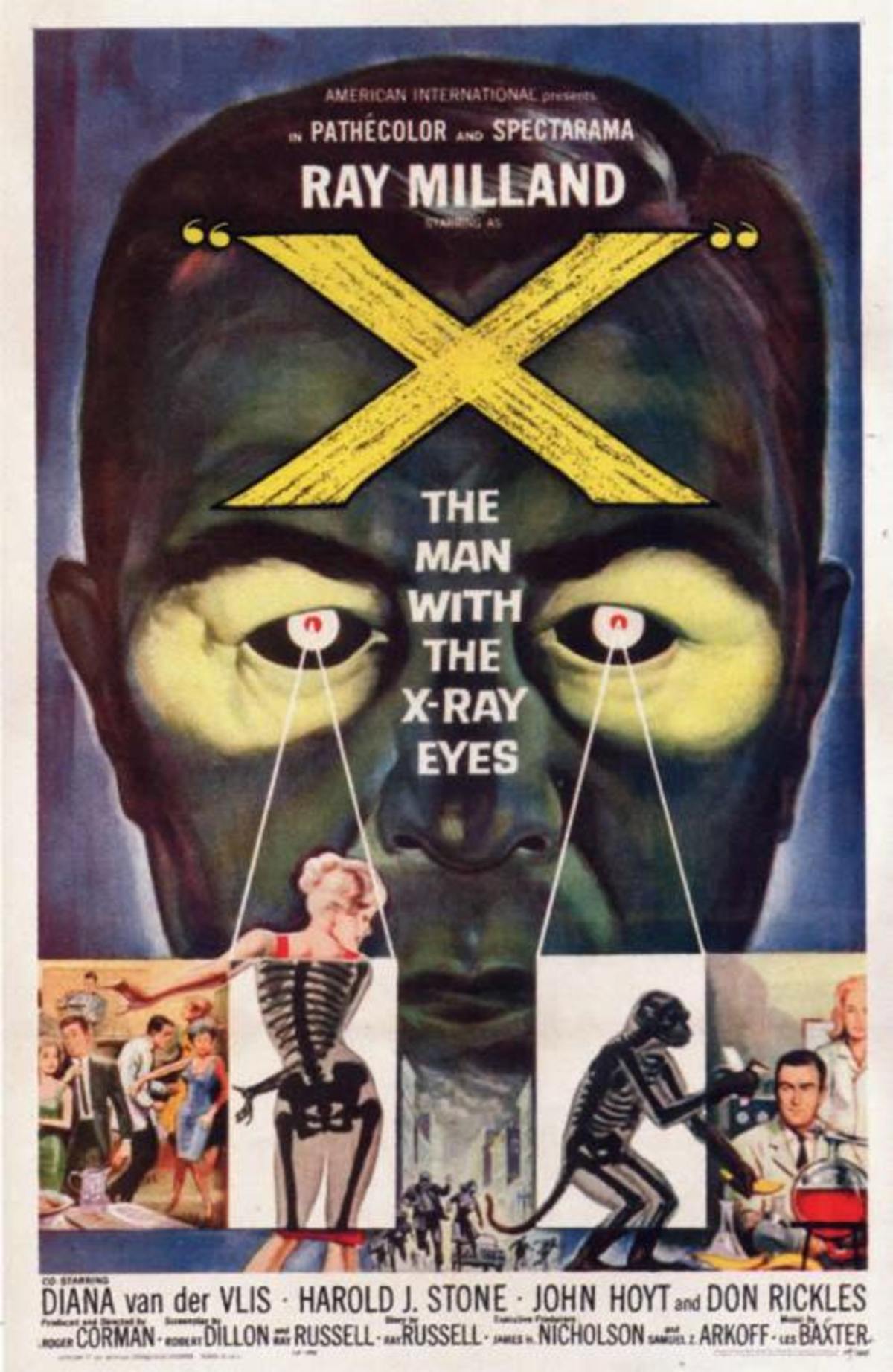 large_06df9d0fbea77238a76709b1612ef5fb-X-RAY-EYES.jpg