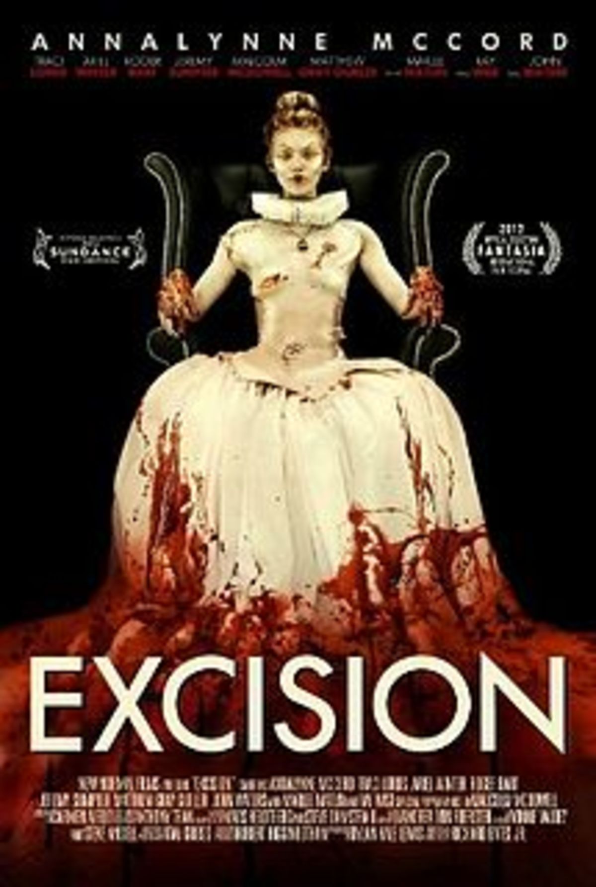 large_ce8e9e33741165aeec0f3c0904aaa75a-excision.jpg